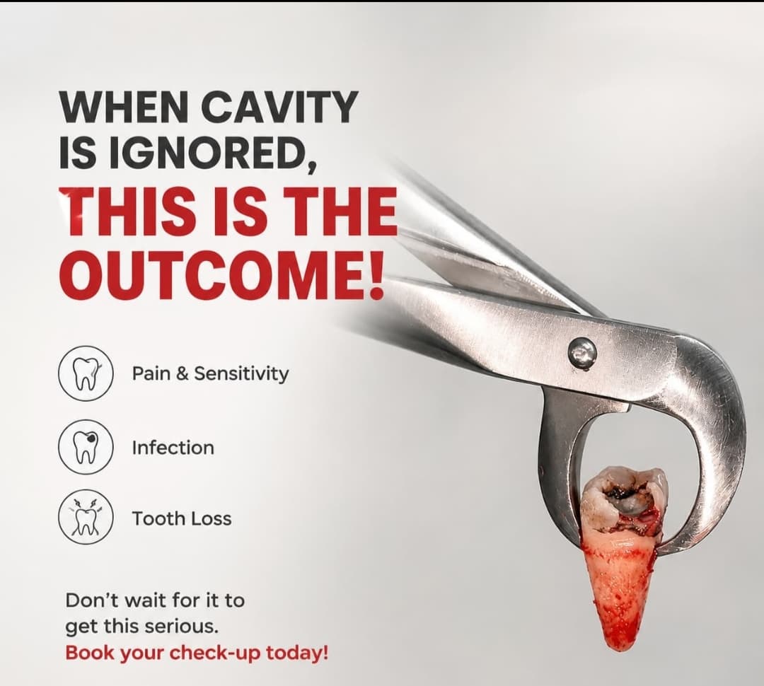 Dental care awareness graphic supplied by Root Care
