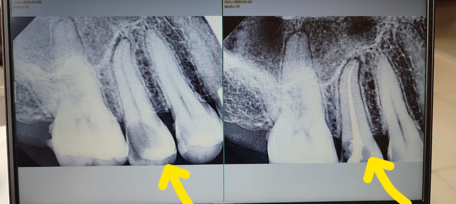 Root Care before-and-after treatment photographs, case 16