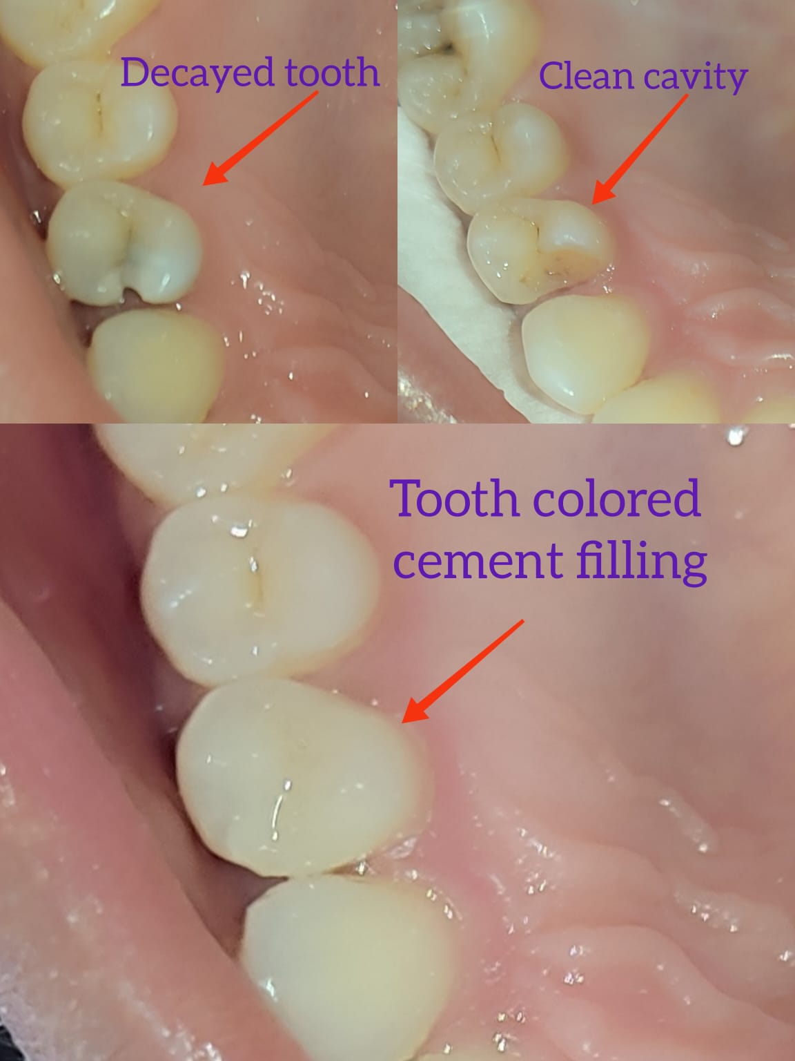 Root Care before-and-after treatment photographs, case 18