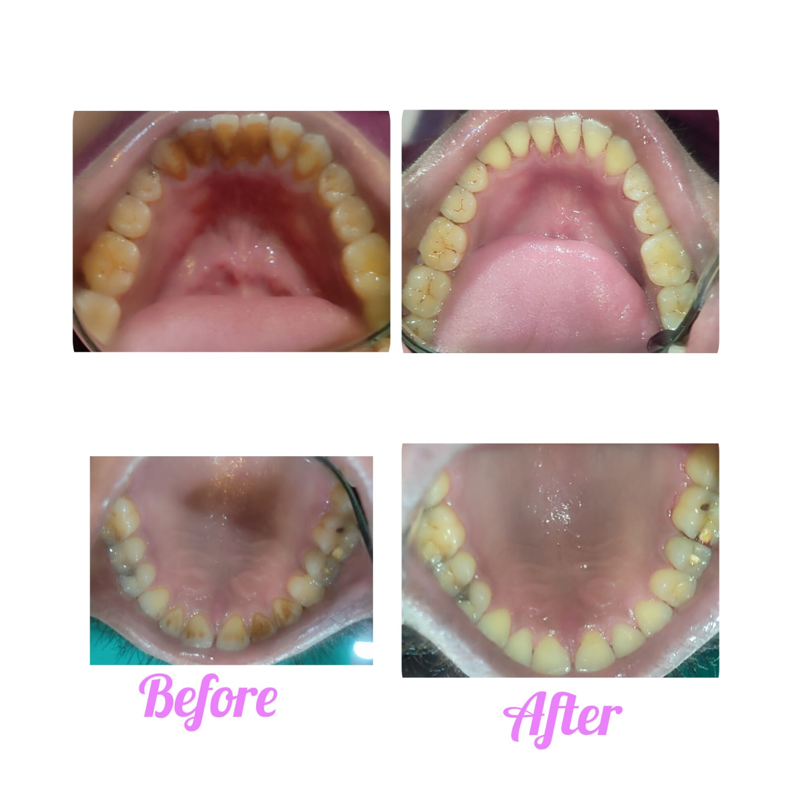 Root Care before-and-after treatment photographs, case 19