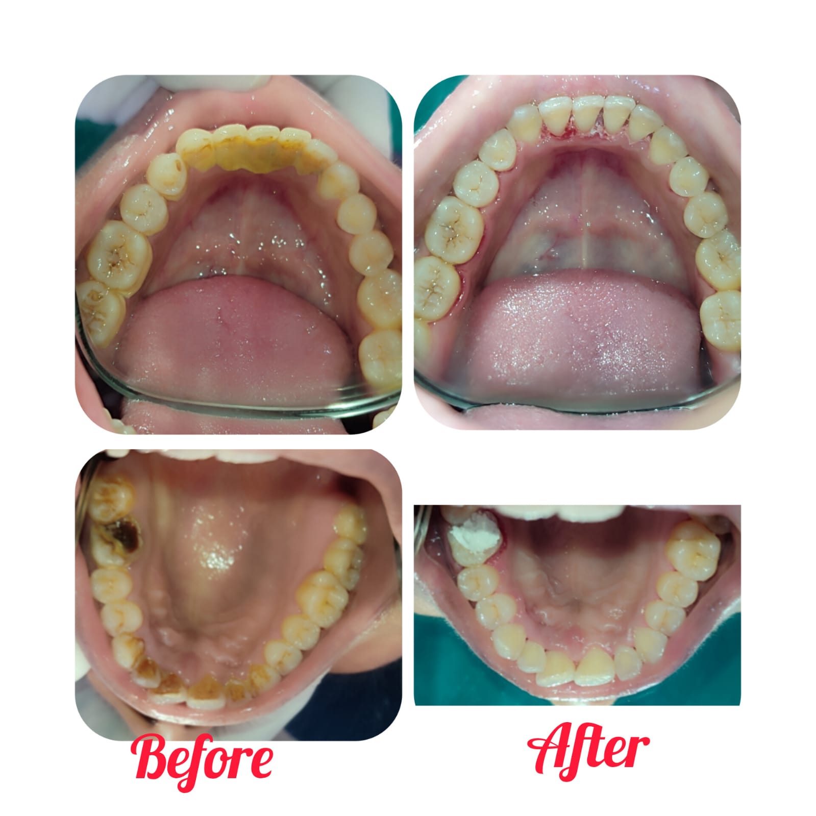 Root Care before-and-after treatment photographs, case 20